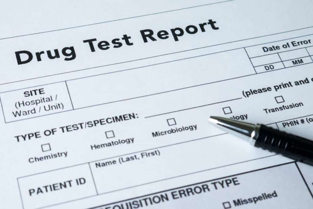 dot-pre-employment-drug-test-is-one-step-in-the-hiring-process